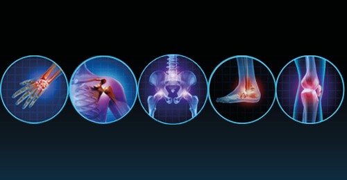 5 tips to ease arthritis effects