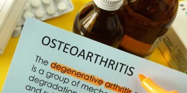 difference between osteoporosis and arthritis