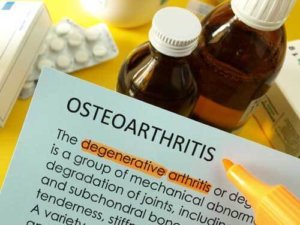 The difference between osteoporosis and arthritis